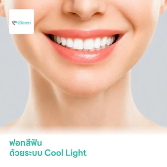 ฟอกสีฟัน ด้วยระบบ Cool Light