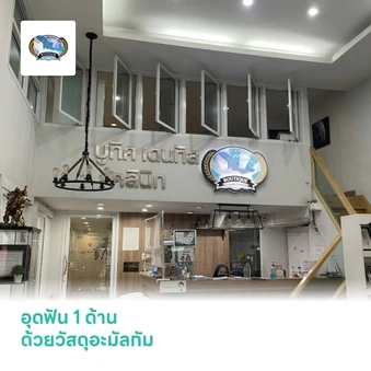 อุดฟัน 1 ด้าน ด้วยวัสดุอะมัลกัม