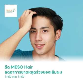 ฉีด MESO Hair ลดอาการขาดหลุดร่วงของเส้มผม 1 ครั้ง แถม 1 ครั้ง