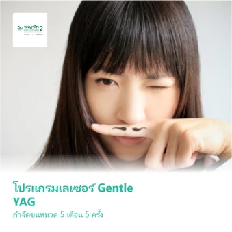 โปรแกรมเลเซอร์ Gentle YAG กำจัดขนหนวด 5 เดือน 5 ครั้ง