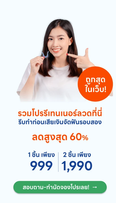 ทำรีเทนเนอร์แบบลวด ราคาเดียวทุกคลินิก
