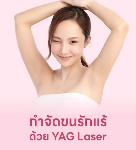 กำจัดขน