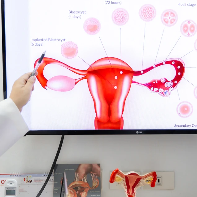 Beyond IVF by Fertility Associates (เมโกะพระราม 2 สหคลินิก) photo 31