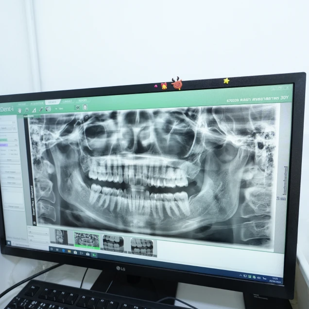 Hobs Dental Clinic (คลินิกทันตกรรมฮ๊อปส์) photo 6