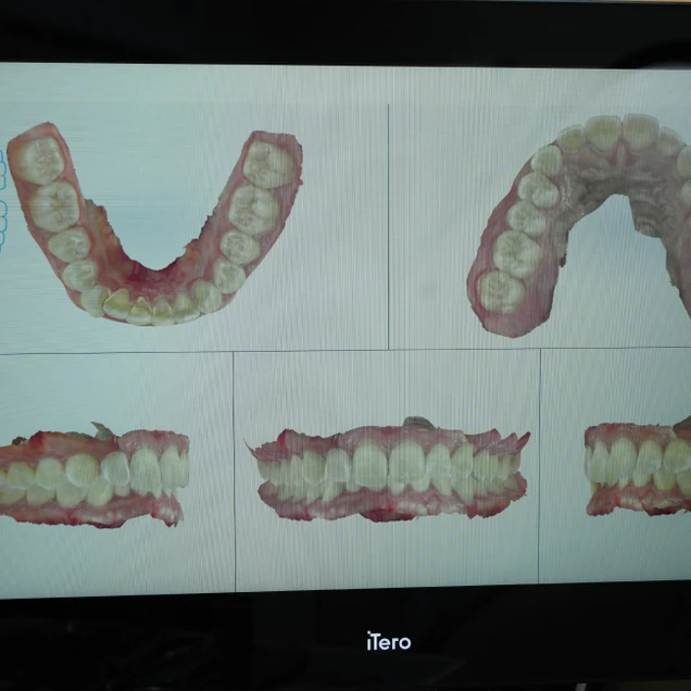 Hobs Dental Clinic (คลินิกทันตกรรมฮ๊อปส์) photo 7