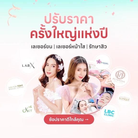 square banner