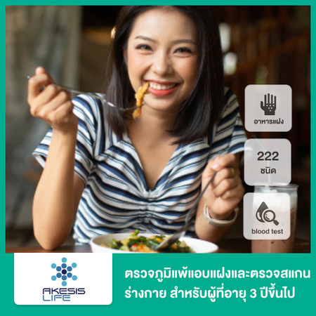 ตรวจภูมิแพ้อาหารแฝง ราคาเท่าไหร่ ที่ไหนดี รวมราคาปี 2567