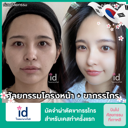ผ่าตัดขากรรไกร ราคาเท่าไร? ตัดกรามที่ไหนดี? รวมสถานที่และราคาปี 2566 ผ่าตัดขากรรไกร ราคาเท่าไร? ตัดกรามที่ไหนดี? รวมสถานที่และราคาปี 2566
