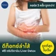 3 ครั้ง + ดริป Liver Detox (เซ็นทรัลเวิลด์)