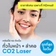 CO2 Laser หน้า+ลำคอ (BTS เสนานิคม+พร้อมพงษ์)