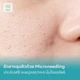 ทดลองก่อน Microneedling 1 ครั้ง