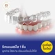 รีเทนเนอร์ใส 1 ชื้น
