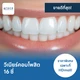 ทำวีเนียร์คอมโพสิต 16 ซี่