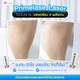 ขนรักแร้ Primelase 12 ครั้ง