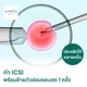 ICSI รวมใส่ตัวอ่อนรอบสด