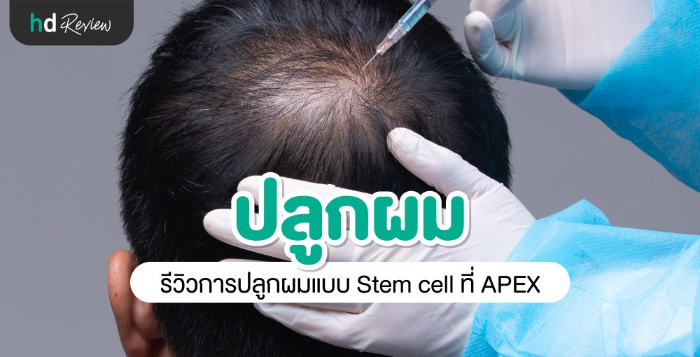 hair-stem-micro-transplant-apex-medical-center-hdmall