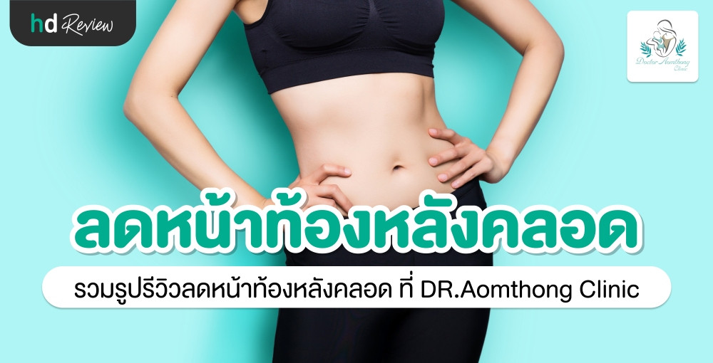 รวมรูปรีวิว ลดหน้าท้องหลังคลอด ด้วยเครื่อง Exilis Ultra Femme 360 องศา ที่  Dr. Aomthong Clinic | Hdmall