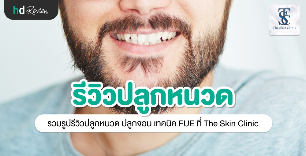 รวมรีวิว ปลูกหนวด ปลูกจอน เทคนิค Fue ที่ The Skin Clinic | Hdmall