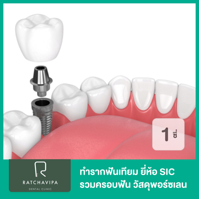 dental-implants-sic-including-crown-porcelain-for-1-tooth-ratchavipa-dental-clinic.jpg