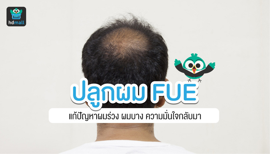 ปลูกผม Fue คืออะไร เจ็บไหม อ่านข้อควรรู้ได้ที่นี่ | Hdmall