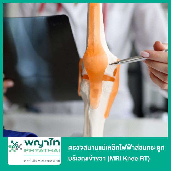 Pfd Rt Knee ตรวจสนามแม่เหล็กไฟฟ้าส่วนกระดูก บริเวณเข่าขวา (MRI Knee RT) ที่ ...
