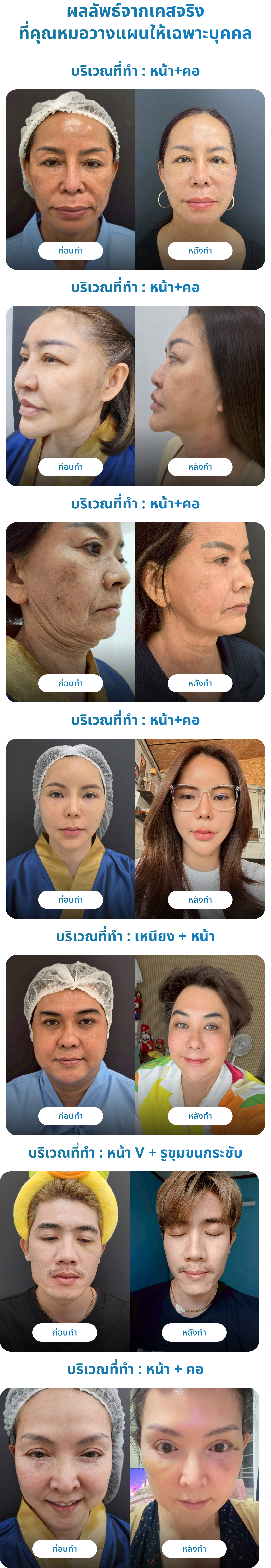 อายุเพิ่มขึ้น ดูแลตัวเองก็ดี <br>แต่ผิวไม่ตึงเหมือนเคย