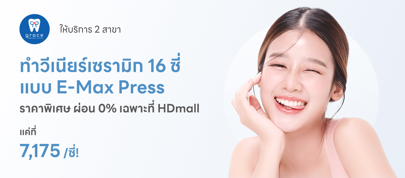 Veneer ceramic 16 ซึ่