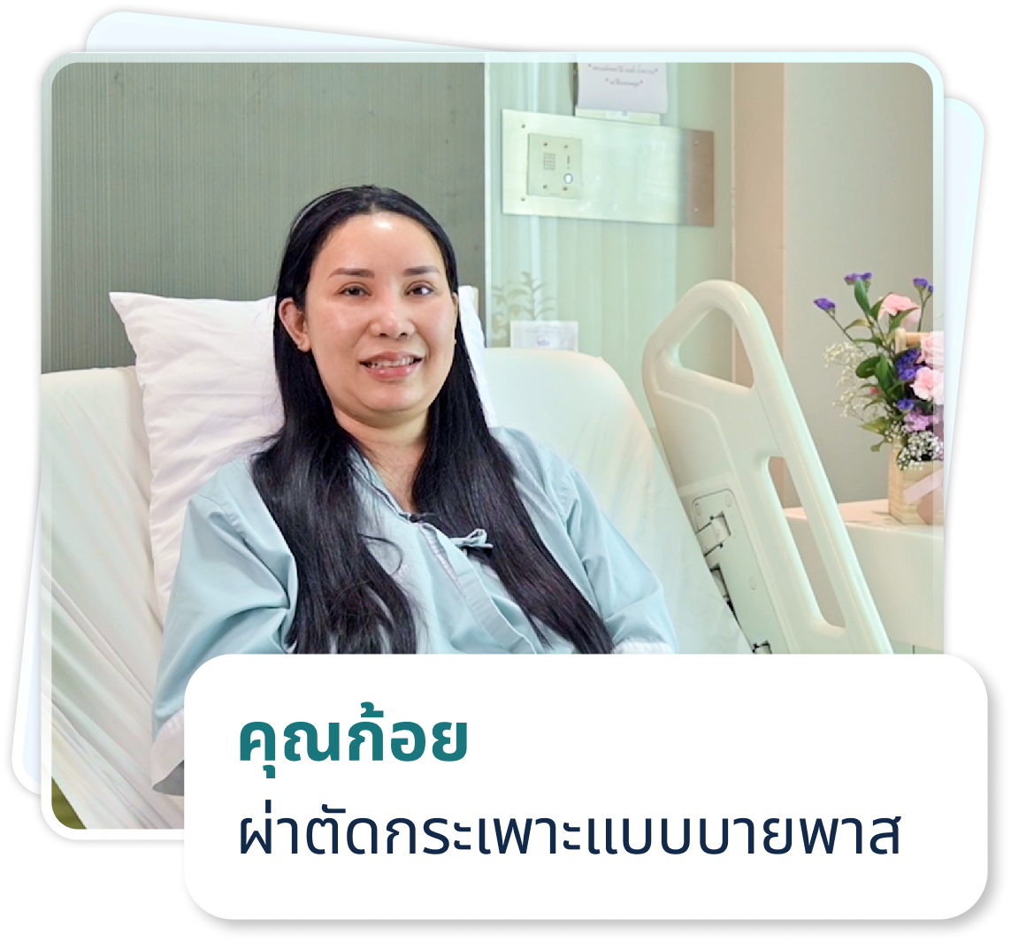 ผ่ากระเพาะรอบสอง