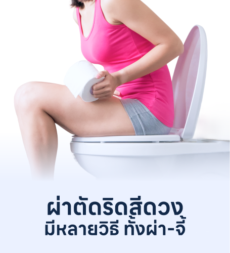 ผ่าตัดริดสีดวง