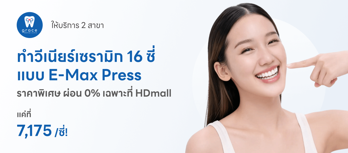 Veneer ceramic 16 ซึ่