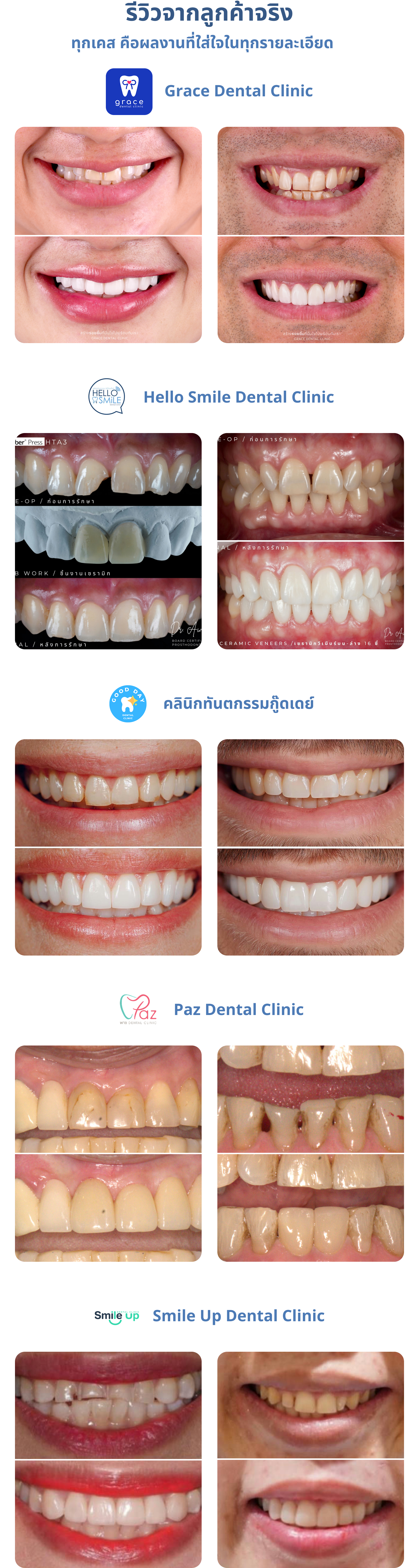 เพราะรอยยิ้มสวยที่แท้จริง