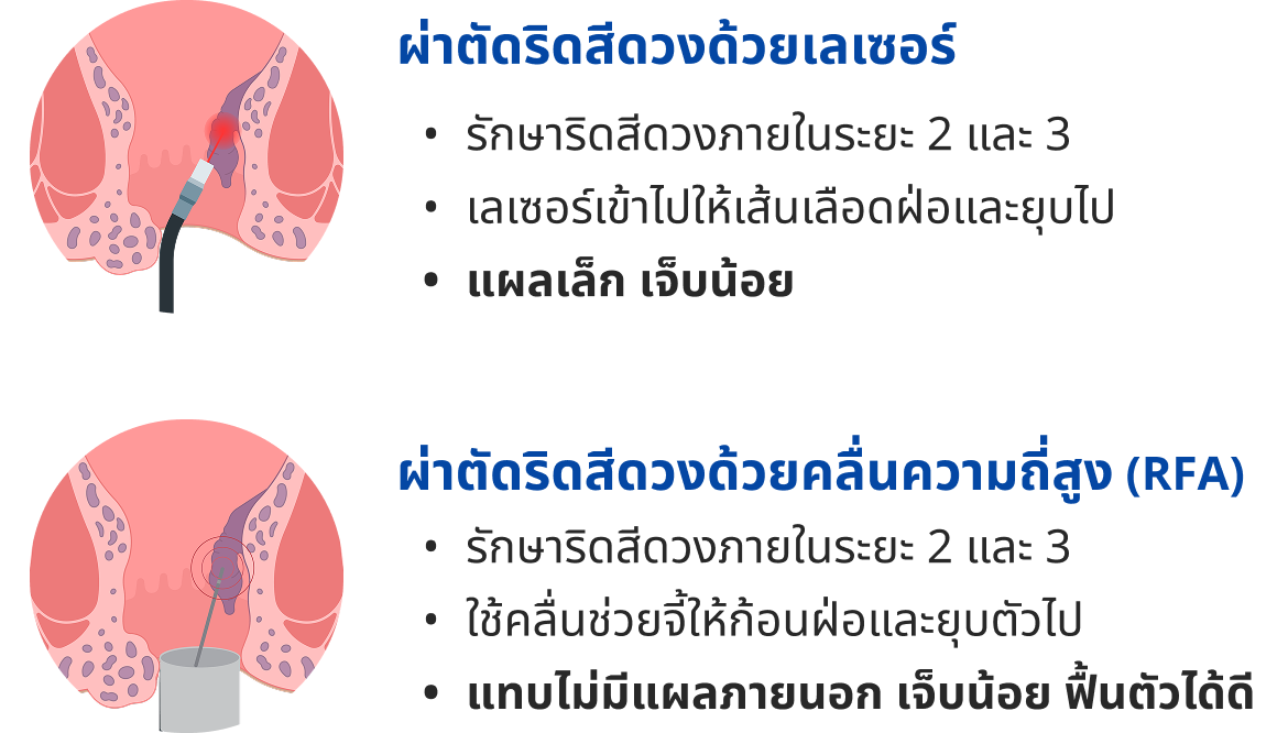 HPV vaccine for teens aged 9-14 years with cost-effective 2-dose schedule